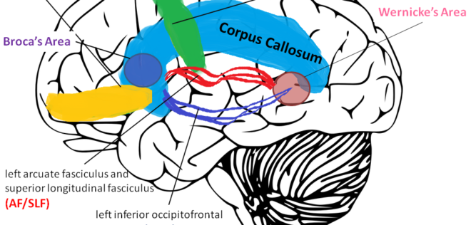 MRI拡散テンソル画像に見られるバイリンガルとモノリンガルの子どもの脳における白質路の形態的相違